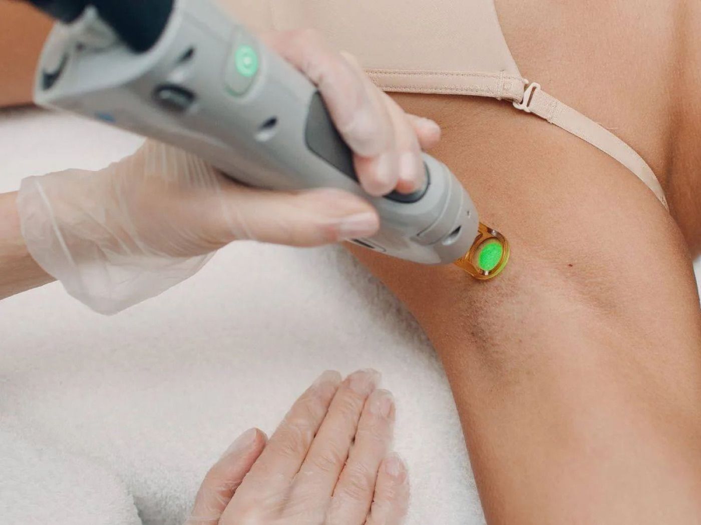 Candela GentleLase σε συνεδρία laser